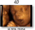 Adorable Baby 4D image