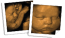 Adorable Baby 3d Ultrasound
